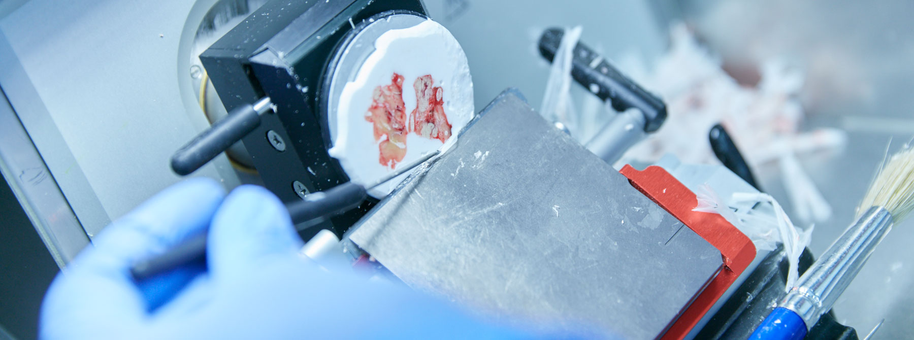 Schnellschnitte erfolgen an nativem, nicht eingebetteten Material. Im Schnellschnittlabor wird die Gewebeprobe zunächst vom Pathologen zugeschnitten und anschließend von MTAs histotechnisch präpariert (Auffrieren der Probe und Schneiden am Kryostaten, Aufziehen der Schnitte auf Objektträger und Schnellfärbung.